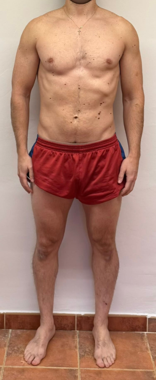 David: fotografía después de su proceso